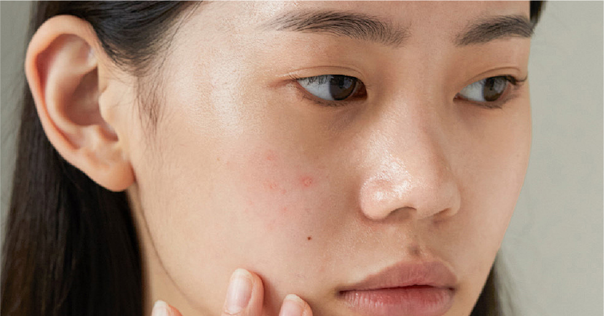 GIHO, 法式28式面部按摩, 法式面部按摩手法, 面部提拉緊致按摩, 改善法令紋按摩, 促進血液循環按摩, 消除面部水腫, 面部按摩促進吸收, 緩解面部疲勞, 淡化色素沉著按摩, 增強皮膚彈性, 面部按摩抗衰老, 面部按摩去皺紋, 面部按摩提亮膚色, 面部按摩手法教程, 面部按摩穴位, 九龍, 沙尖咀, 沙尖咀按摩, 沙尖咀美容, 九龍美容, 九龍按摩, 按摩