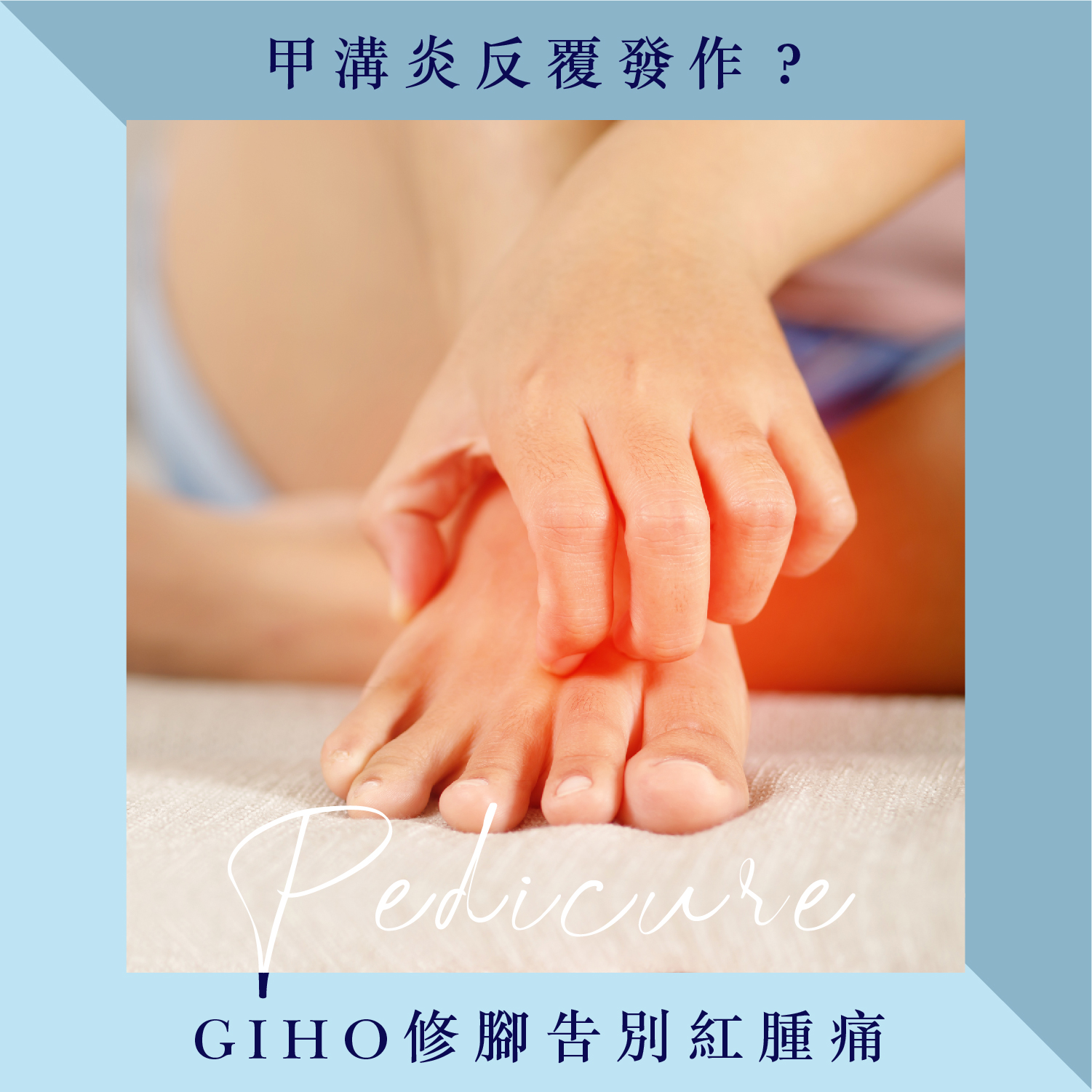 甲溝炎反覆發作？GIHO修腳告別紅腫痛